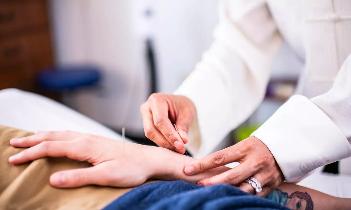 1 or 2 Rejuvenating Acupuncture Sessions for Stress Relief at Lotus Acupuncture Up To  50% Off - Primary Image