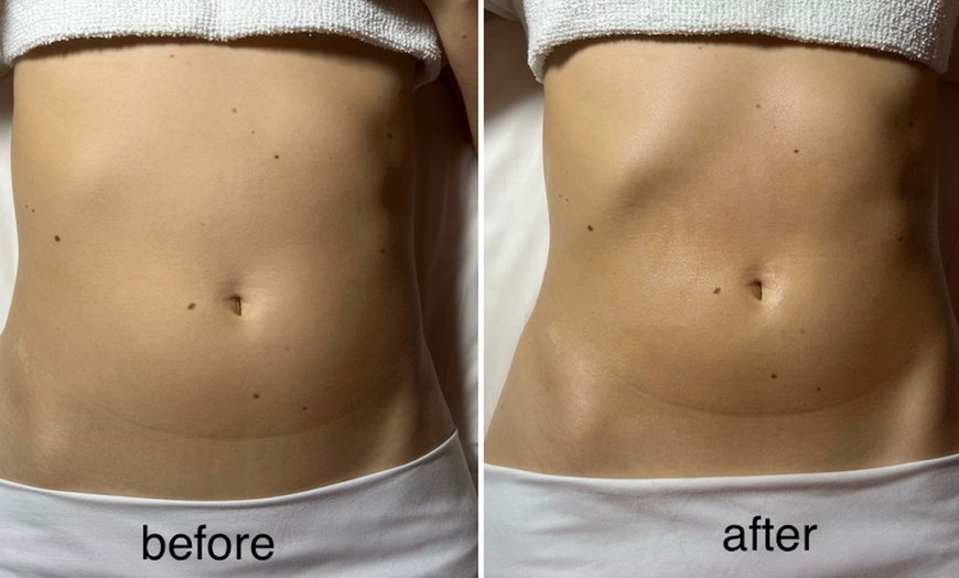 Image 5: One or Three 90-Minute Brazilian Lymphatic Drainage Sessions