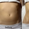 Image 5: One or Three 90-Minute Brazilian Lymphatic Drainage Sessions