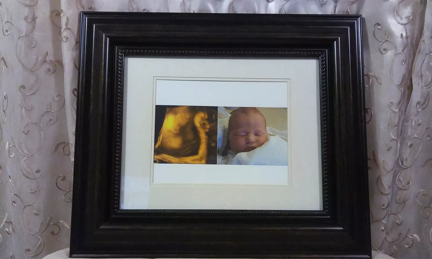Experience PEEK-A-BOO 3D/4D's variety of ultrasound packages, offering up to 39% off, for a sneak peek at your little one. - Primary Image