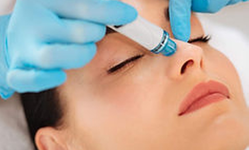 Image 2: Experience Youthful Radiance w/ 20, 40, or 60 Units of Botox Treatment