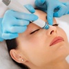 Image 2: Experience Youthful Radiance w/ 20, 40, or 60 Units of Botox Treatment