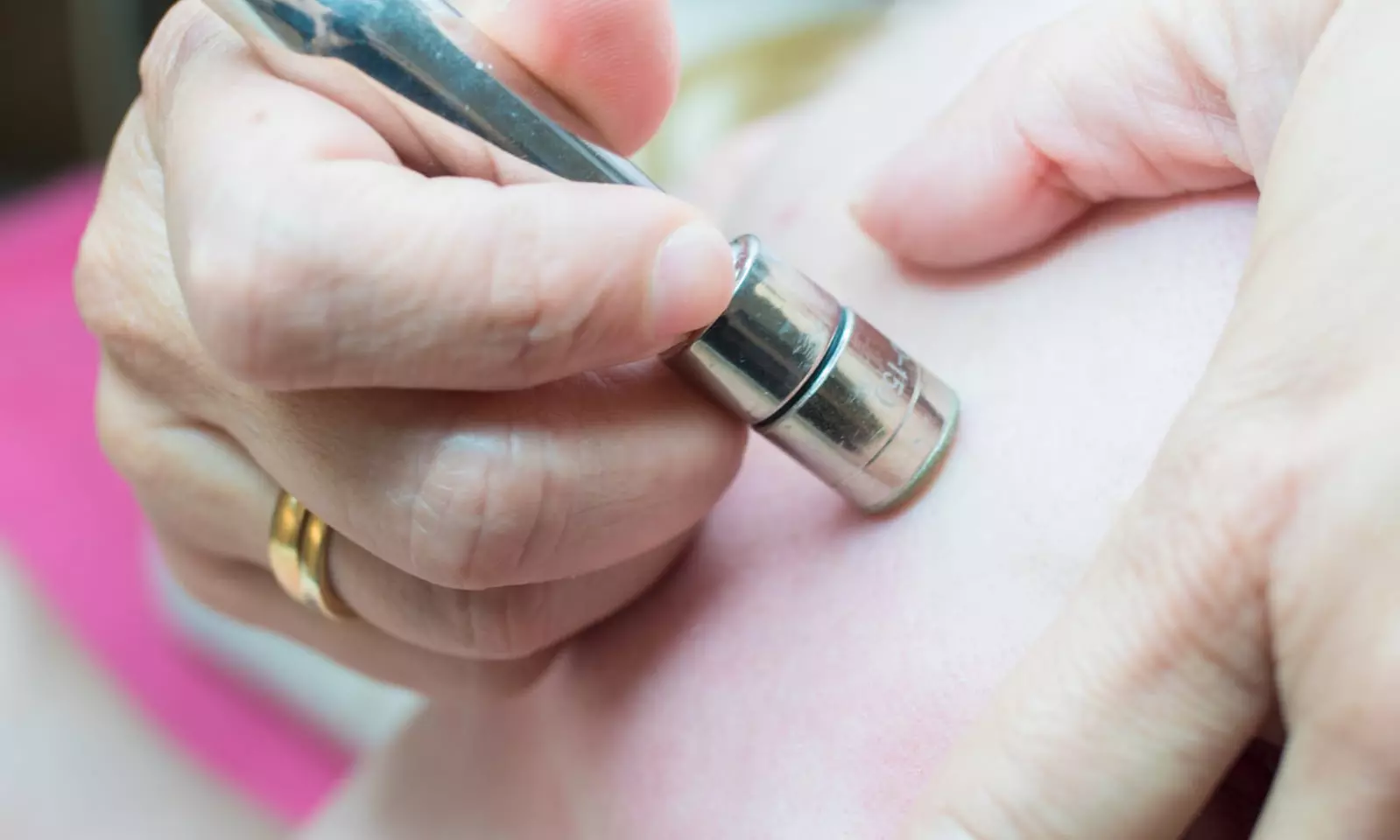 Limpieza facial con microdermoabrasión, peeling, masaje y crioterapia