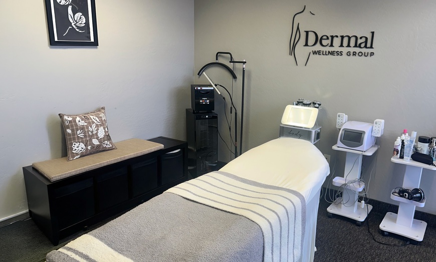 Image 5: Firmer, Youthful Skin with Radio Frequency Tightening for Face or Neck