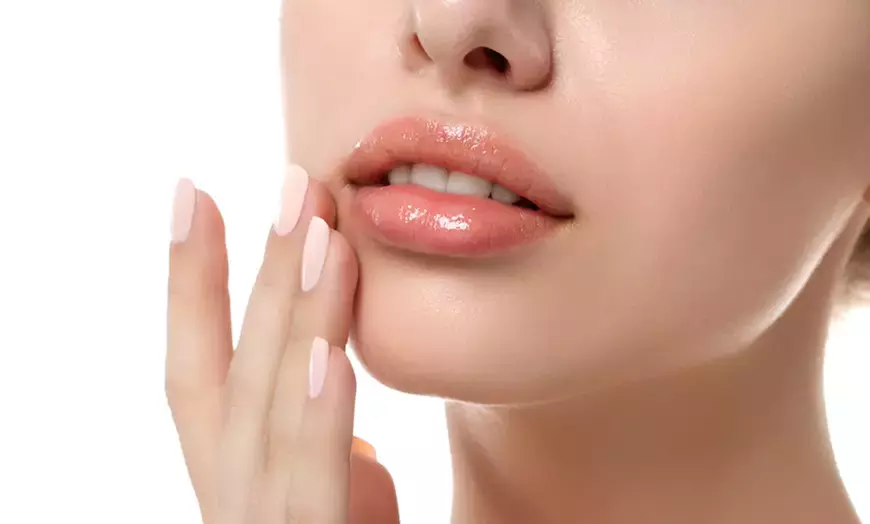 Experience Natural Lip Enhancement at Lida M. Vargas, DDS with ER-YAG Laser Sessions up to 25% Off - Primary Image
