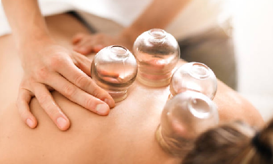 Image 2: Relieve Tension with a 30-Minute Cupping Session