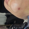 Image 3: 60-Min Lymphatic Drainage: Post-Op, Wellness, or Face/Chin Recovery