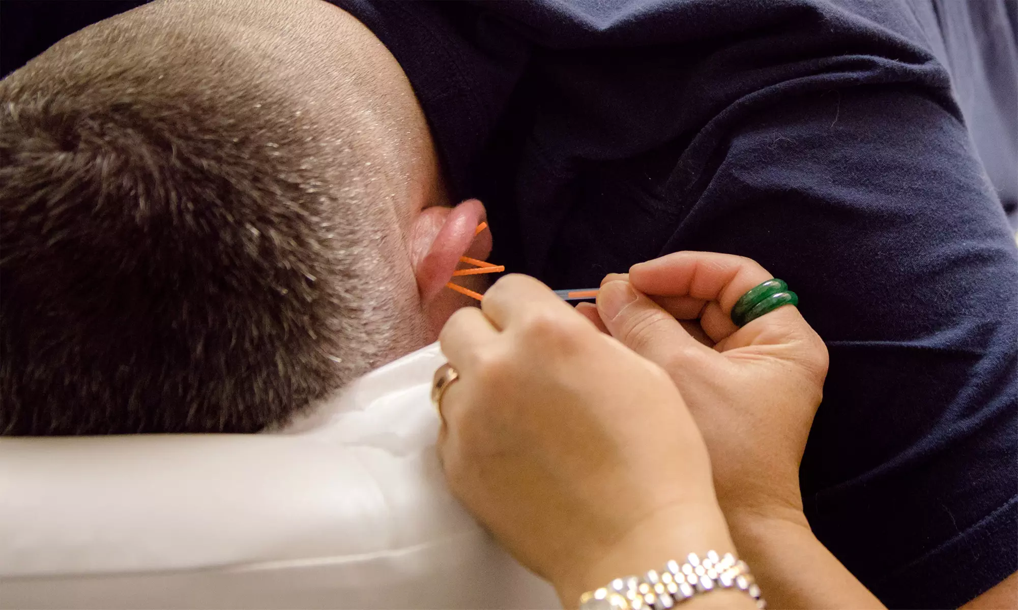 Up to 45% Off on Acupuncture at Natural Healing Rx, LLC - Second Medium