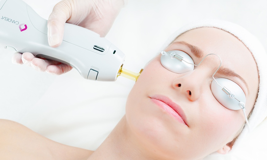 Image 4: Laser Hair Removal