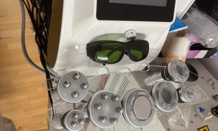 Image 10: Sesiones de cavitación con presoterapia y opción a tratamiento