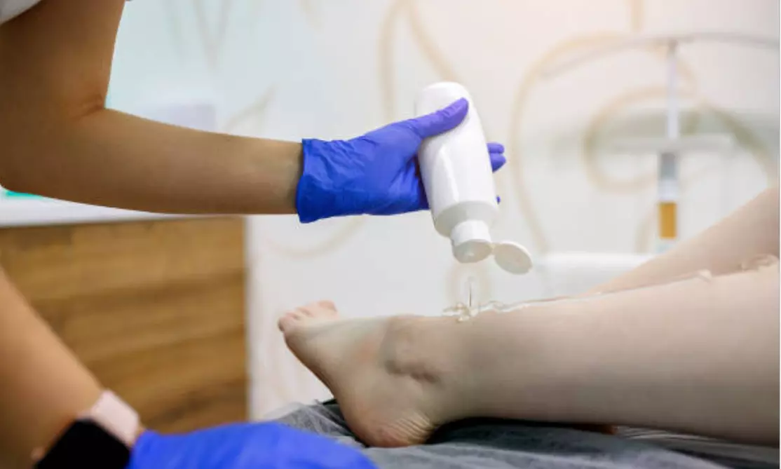 ¡Descubre la depilación láser en Eraesthetic!