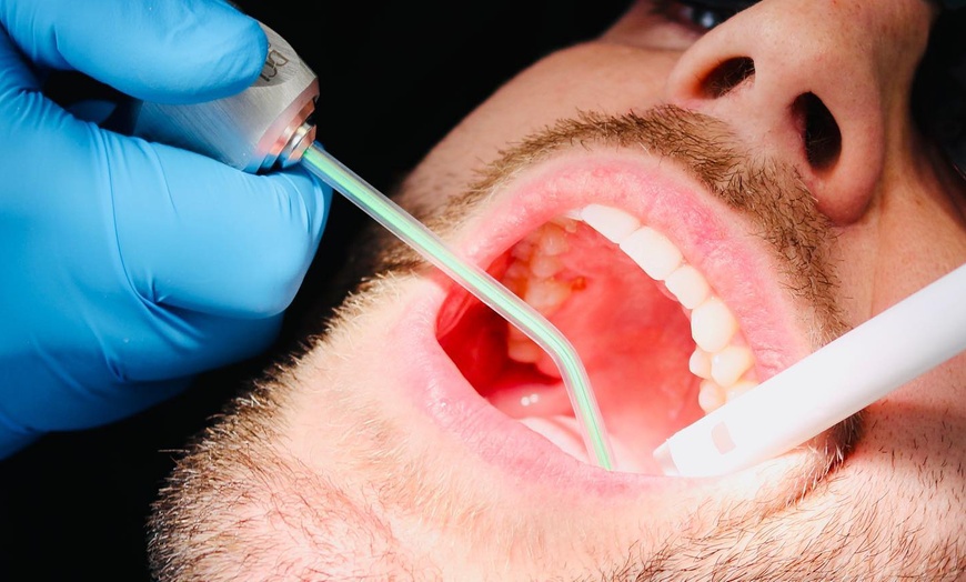 Image 2: One 30-Minute Hygienist Appointment at Dental Studios