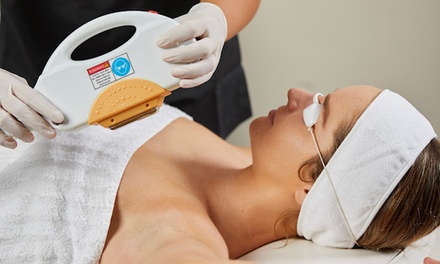 One Session of IPL Hair Removal  - Half Arms