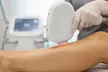 Laser Hair Removal (1–3 Sessions) for Face, Arms & Legs at Laserlux Hair Removal(Up To 34% Off) - Image 2
