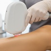 Image 2: Laser Hair Removal Packages – Face, Arms, Legs & More