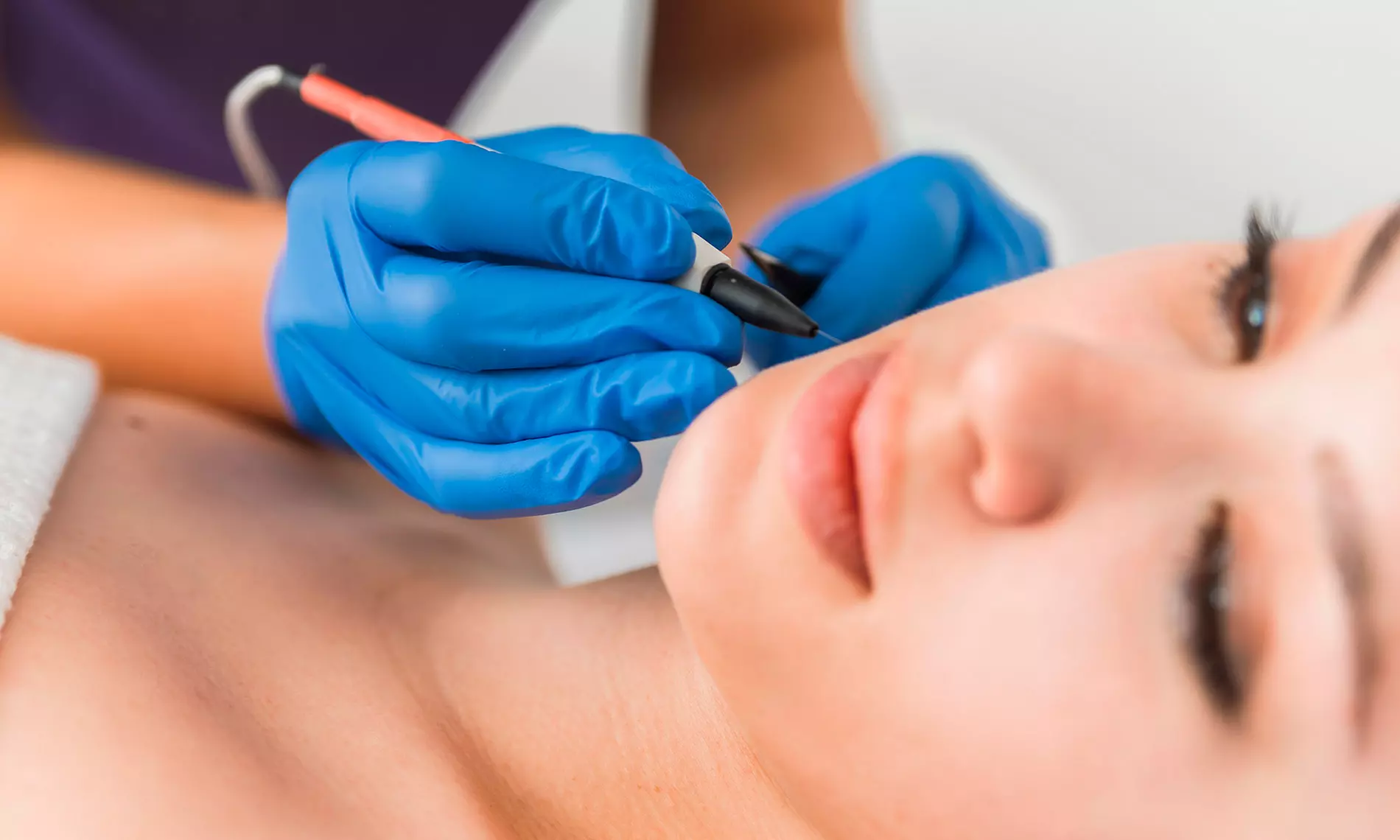 Up to 50% Off on  at Mint Studio Electrolysis - Primary Image