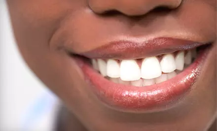 Sapphire Teeth-Whitening Session for One or Two at Faircourt Dental Smile Enhancement Studio in Grosse Pointe Woods (Up to 64% Off) - Primary Image