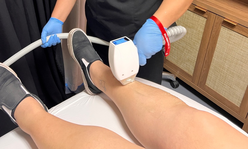 Image 2: Six Laser Hair Removal Treatments on Small, Medium, or Large Area