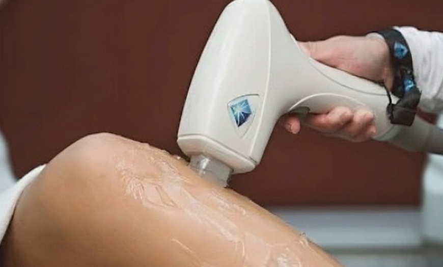 Image 6: 1, 3 o 6 sesiones de depilación láser en zona a elegir