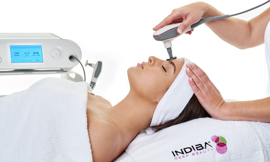 Image 3: Radiofrecuencia en rostro, cuello y escote