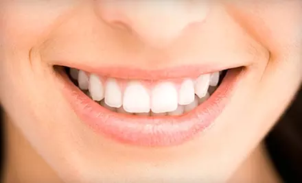 $39 for Dental Exam, Cleaning, X-rays, and Take-Home Whitening Kit at River Bend Dental Group ($425 Value) - Primary Image