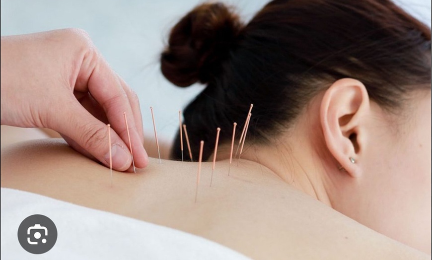 Image 1: Acupuncture & Chiropractic Wellness: Single or Combo Sessions