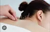 Acupuncture & Chiropractic Wellness: Single or Combo Sessions at Accurate Chiropractic Care (Up to 71% Off)