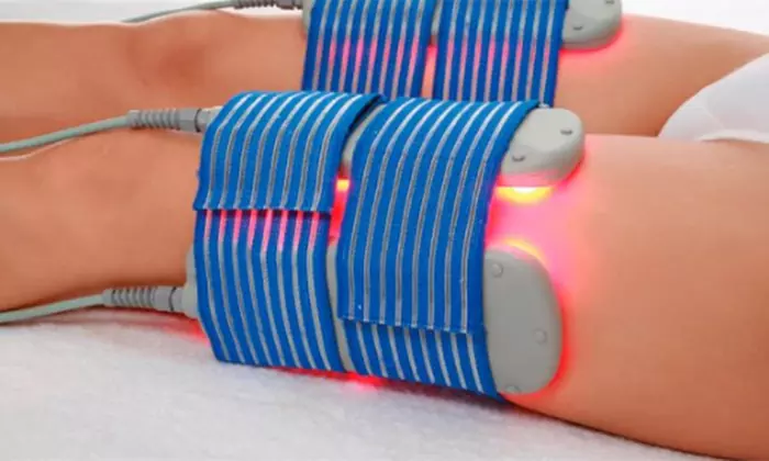 3, 6 o 12 sesiones de lipoláser con presoterapia y masaje drenante desde 29,95 € en Marfil Zaragoza - Primary Image