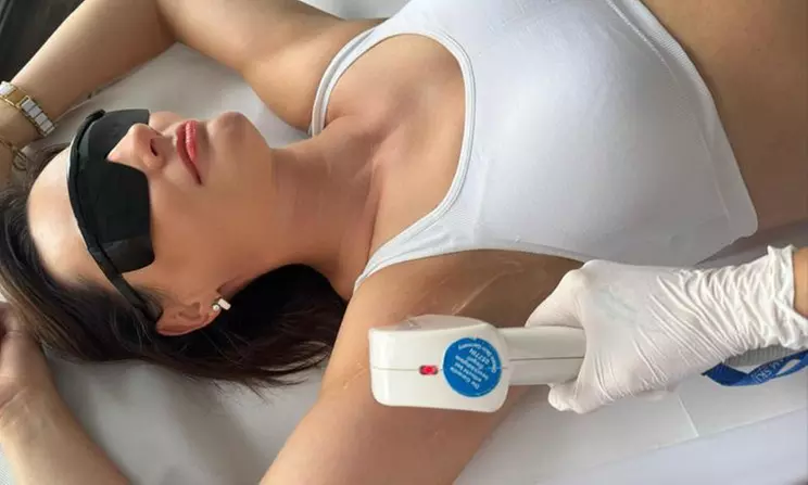 Endlich haarfrei:IPL mit SHR Modus od. 3 Wellen Diodenlaser Behandlung