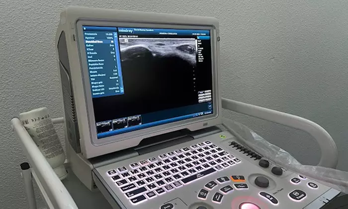 Hasta 46% de dto. en Fisioterapia en Fisio 46 Chamartín