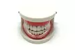 1, 2 o 4 protectores bucal antibruxismo - Second Medium