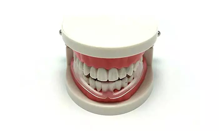 Protector bucal antibruxismo