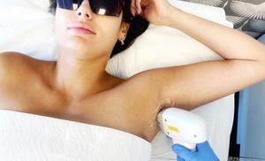 Achieve Smooth Skin with 6 Laser Hair Removal Sessions