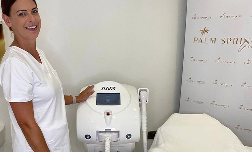 Image 3: Reveal Smoother Skin at Palm Springs Laser Through Laser Hair Removal 