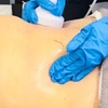 Image 2: Up to 67% Off on Radio Frequency Skin Tightening at Silhouette Aesthetic