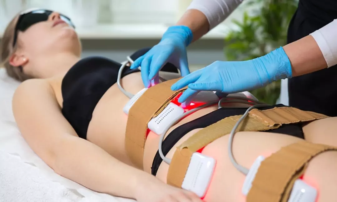 Royal Beauti Bar offers up to 39% off on Laser Lipo with one, five, or ten sessions for targeted fat reduction - Primary Image