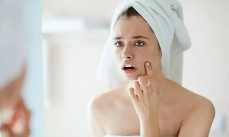 Learn from International Open Academy's Acne Course, Master Skincare Online with up to 94% Discount - Primary Image