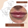 Image 6: Define Your Lips with Expertly Applied 0.5ml or 1ml Dermal Filler 
