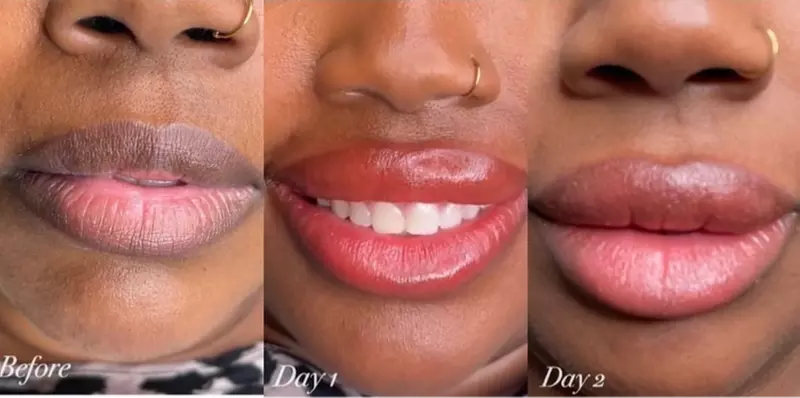 Up to 53% Off on Lip Enhancement at Jm Aesthetica - Primary Image