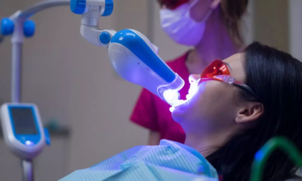 Up to 51% Off on Teeth Whitening at Brites Teeth Whitening Spa - Second Medium