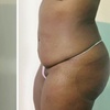 Image 3: 1 Infrared Detox Full Body Sauna Wrap or 3 Ionic Detox Foot Baths