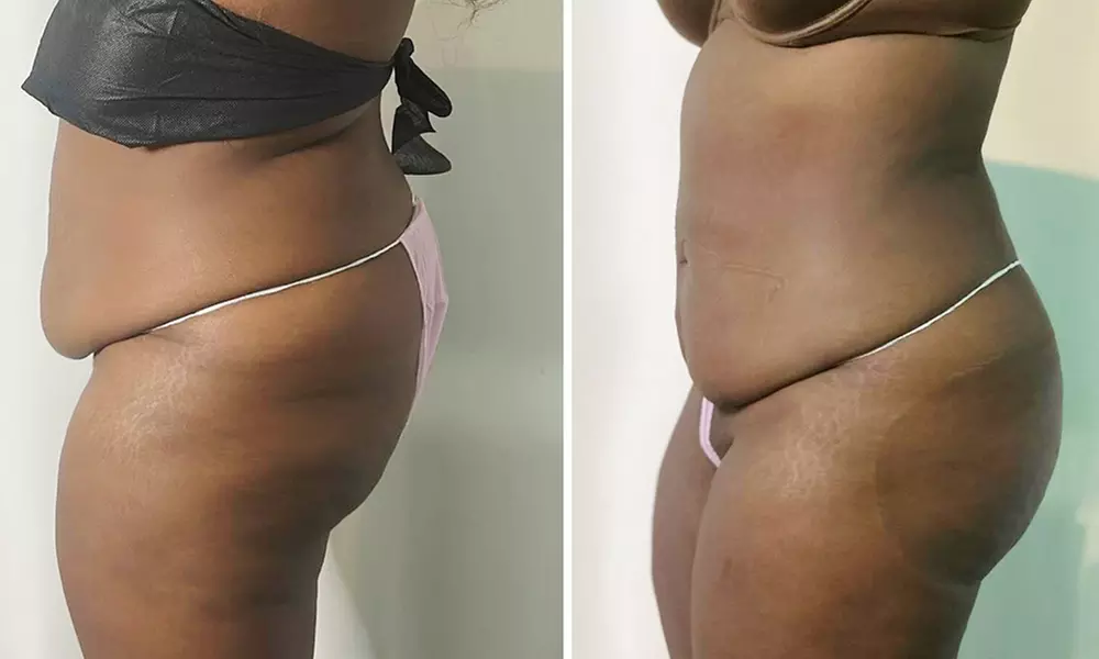 1 Infrared Detox Full Body Sauna Wrap or 3 Ionic Detox Foot Baths