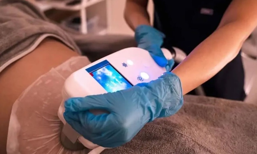 Image 6: One Session of Fat-Freezing Cryolipolysis at BM Aesthetics