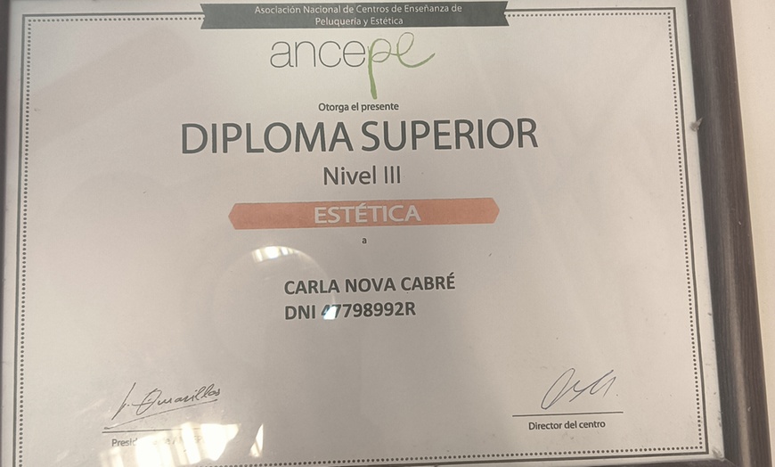 Image 5: Fotorejuvenecimiento facial y eliminación de manchas con laser IPL