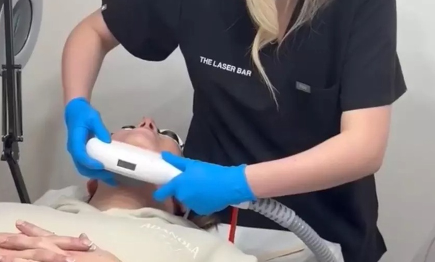 Image 2: Six Laser Hair Removal for Small, Medium, Large or Full Body Areas
