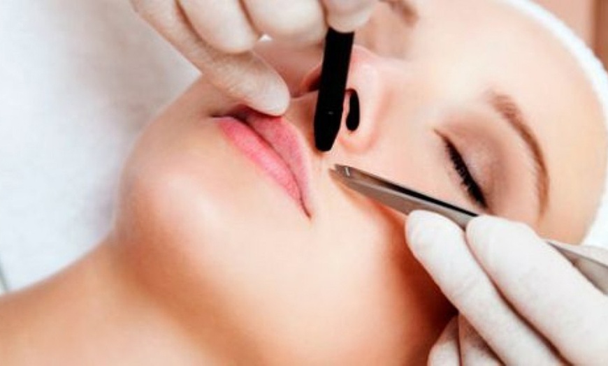 Image 3: Bono de 3 sesiones de depilación eléctrica de 15, 30 o 60 minutos