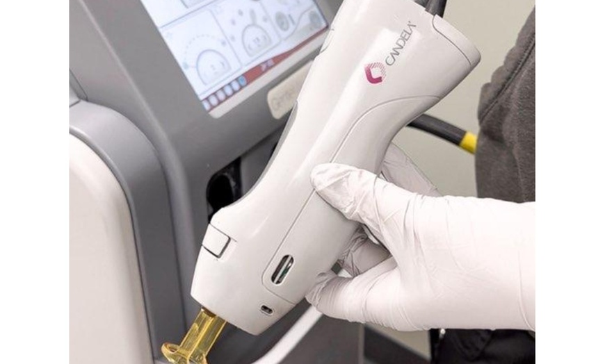 Image 3: Laser Hair-Removal Sessions on a Small, Medium or Large Area.