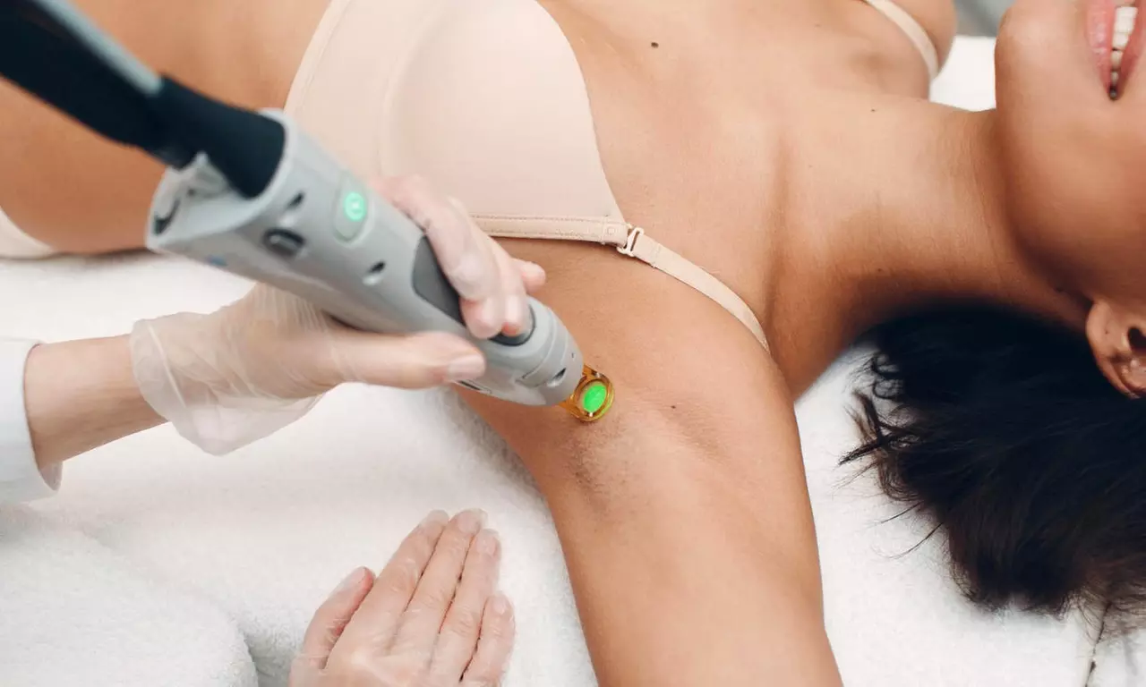 Shave Less, Live More with One, Three, or Six Sessions of Laser Hair Removal on Preferred Areas on 80% Off - Primary Image