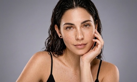 One Potenza Microneedling Radio Frequency Treatment for Full Face and Neck - Weekend Weight Loss Center-Multi-Location