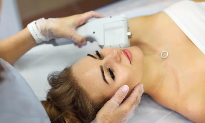 Image 2: Up to 79% Off on Facial 12D HIFU at Violett Bella Casa